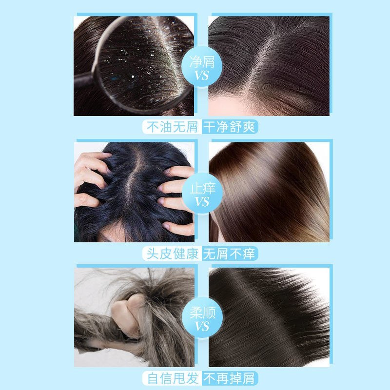 发刻舒洗发水留香持久女男士去屑控油去油止痒清爽飘逸家庭装