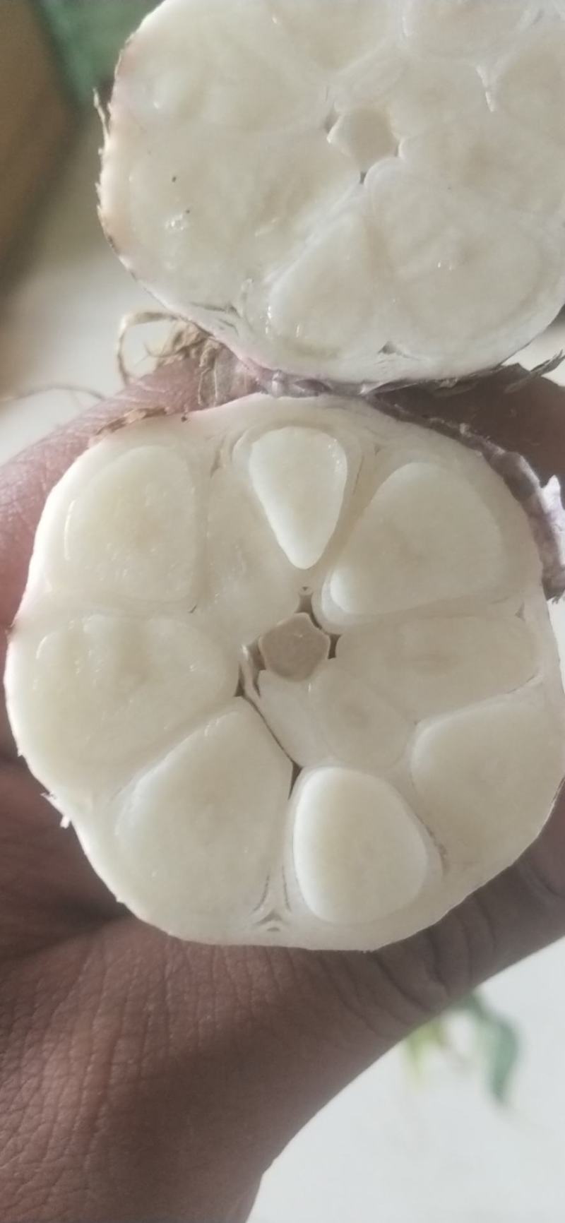 本地大蒜上市了