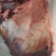 小脸肉