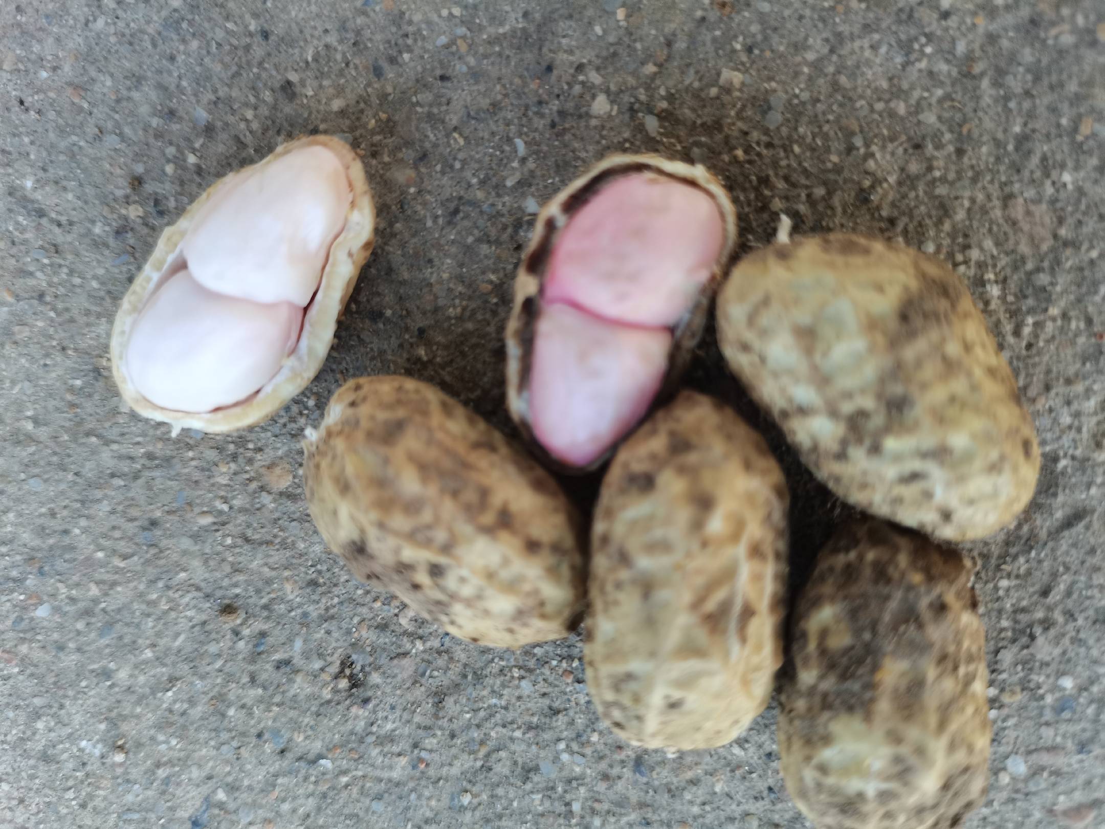 拔牙后饮食建议