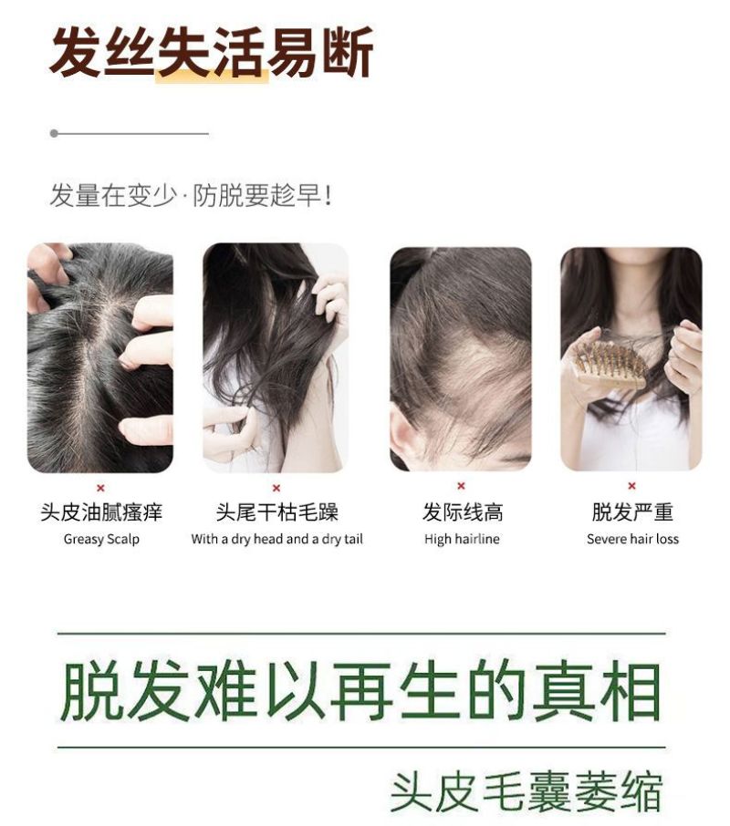 侧柏叶植物防脱发洗发水增发密发育发祛屑止痒控油蓬松除螨虫
