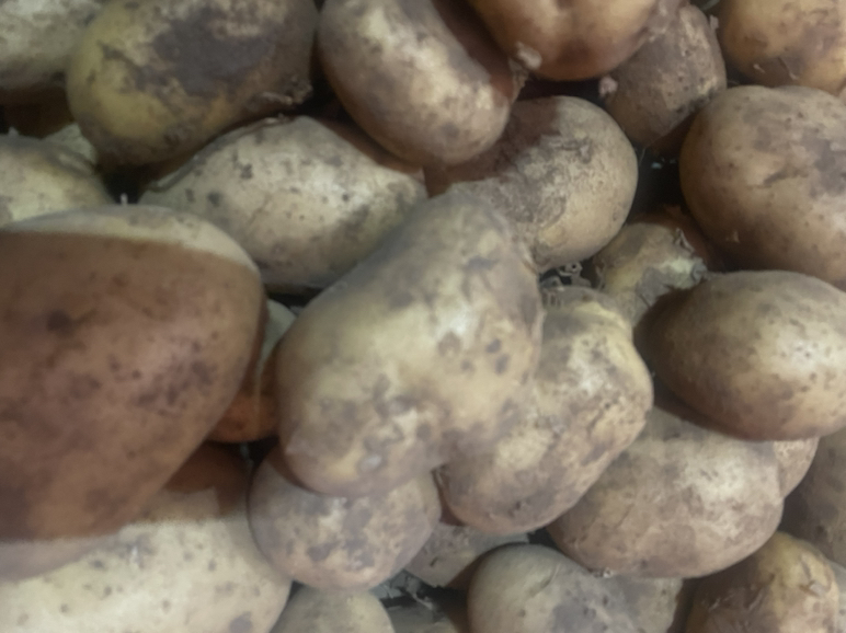 尿酸高人群健康饮食建议