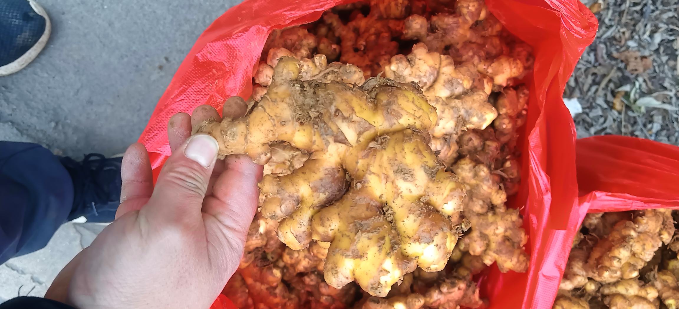 展示一个人正在将生姜片敷在头部太阳穴区域,并用毛巾包裹保温 生姜敷贴使用示意图
