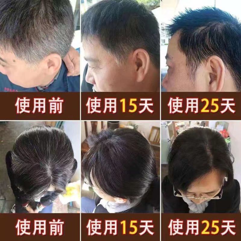 白发转黑洗发水黑发神器头部清洁何首乌去油去屑
