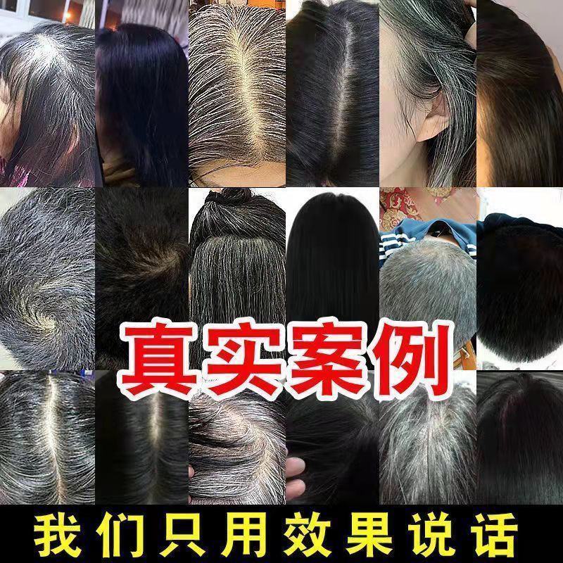 白发转黑洗发水黑发神器头部清洁何首乌去油去屑