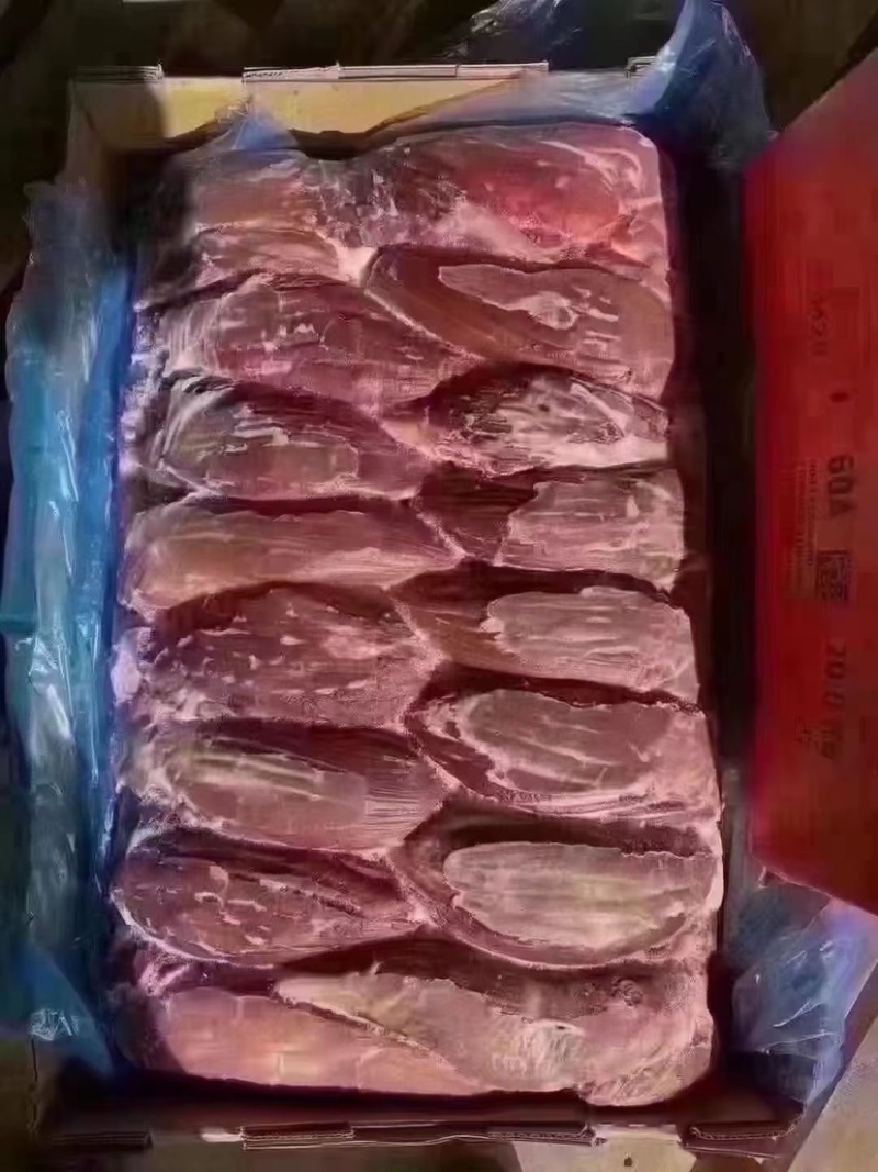 排腱