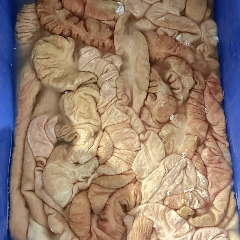 大肠