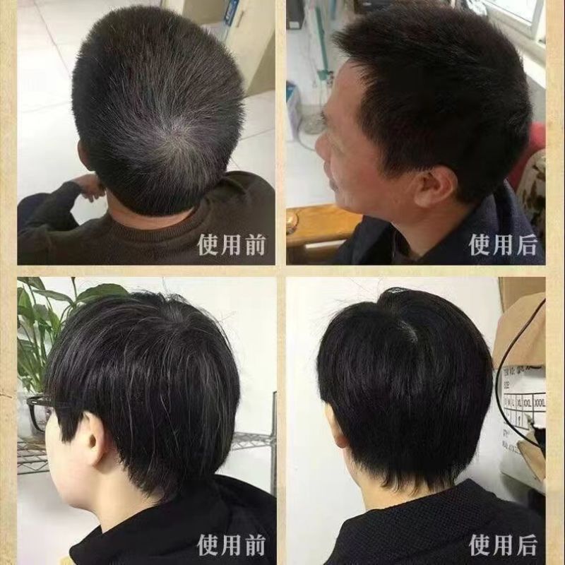 白发转黑何首乌洗头液防脱发根转黑洗