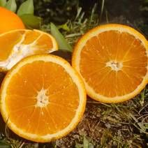 湖南脐橙精品纽荷尔脐橙大量上市产地货源规格齐全