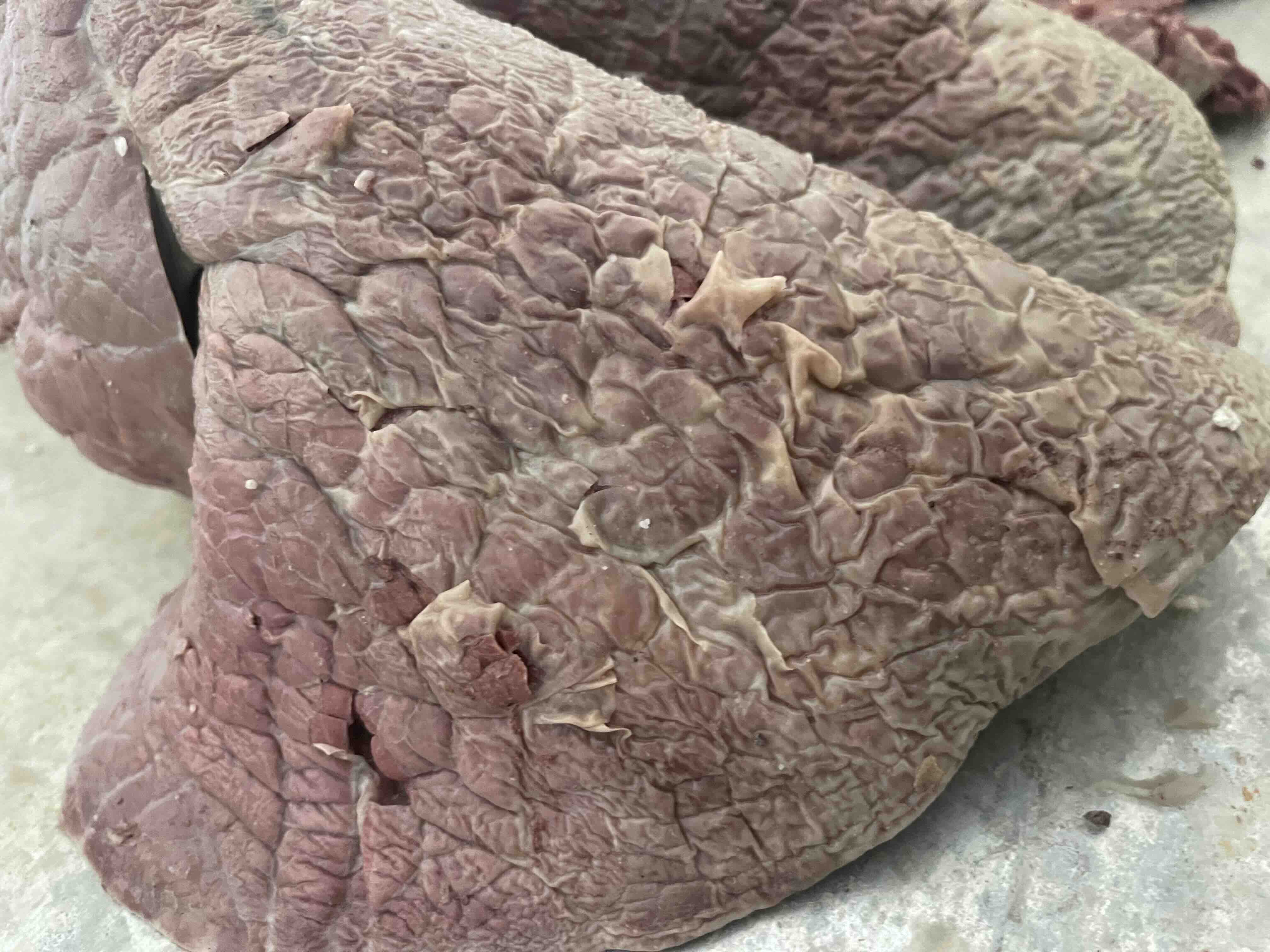 肺部CT影像与健康饮食对比示意图