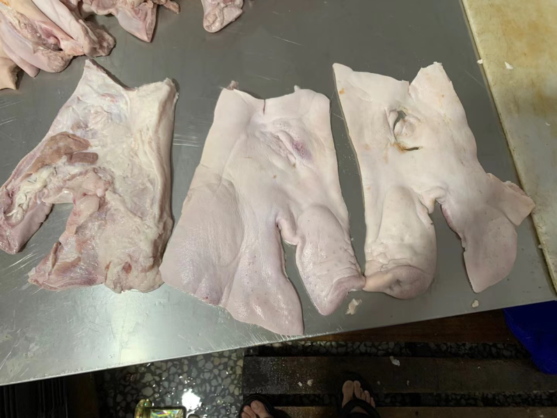 去耳头皮