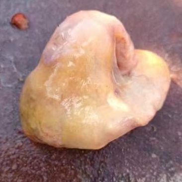 鸡宝