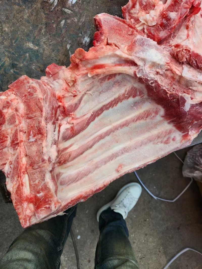 去颈前排