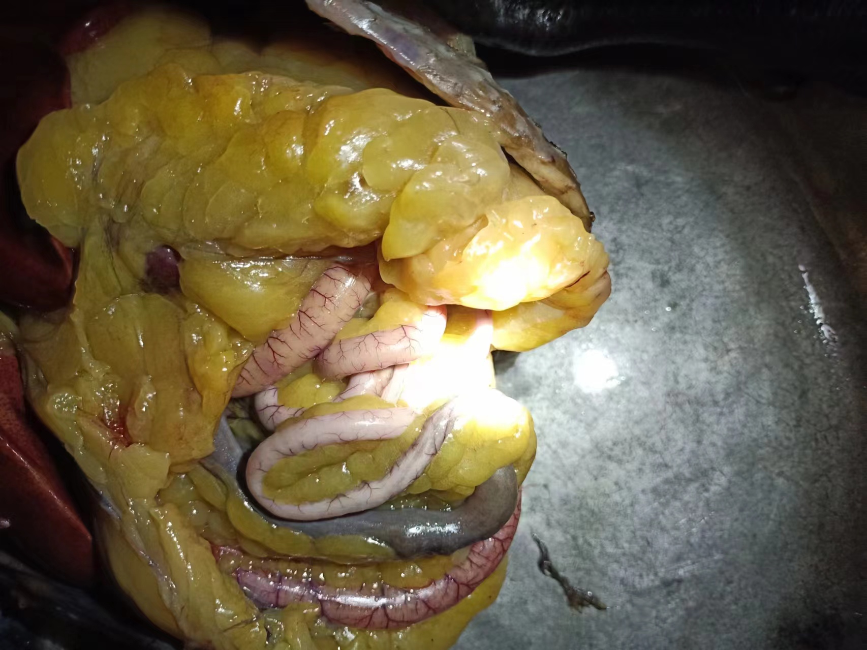 消化系统示意图