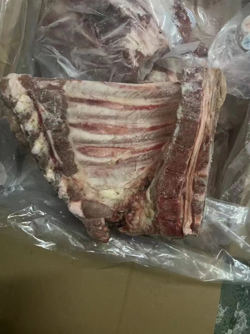 去颈前排