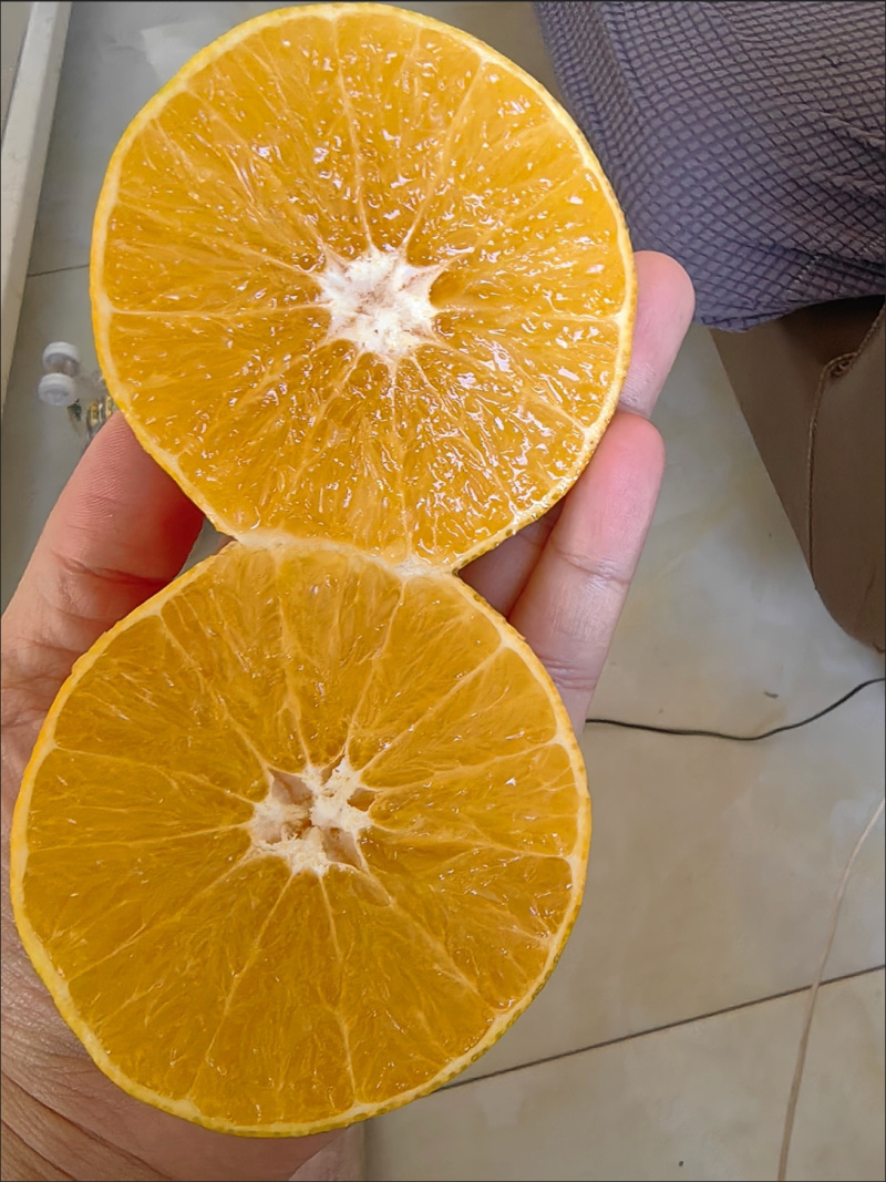 【今日优选】爱媛38号果冻橙超甜四川现摘新鲜水果薄皮橙子批发