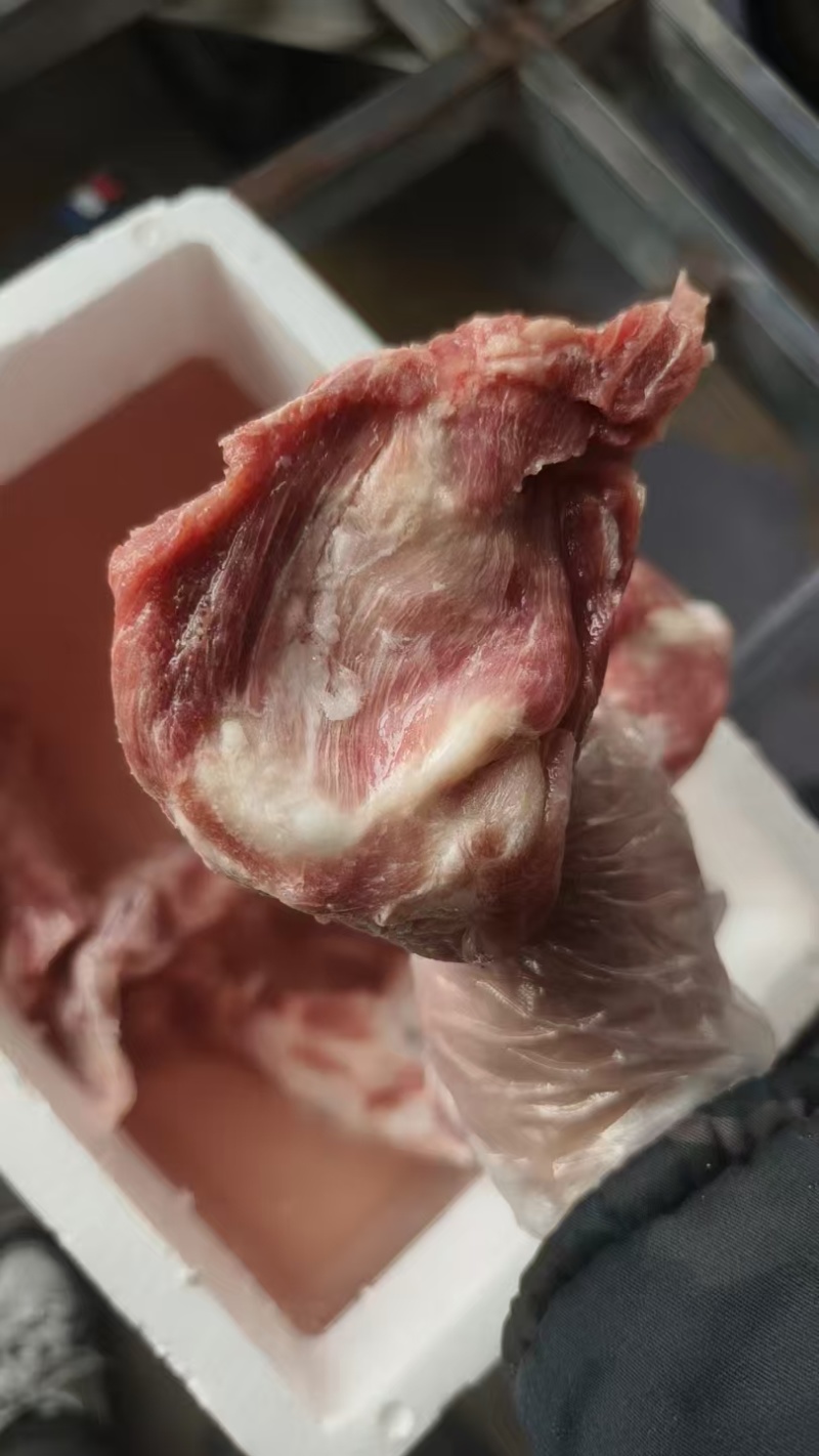 我是厂家去颈骨头