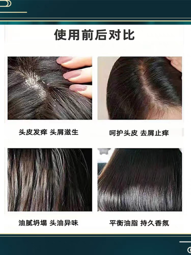 滋源无患子控油清爽洗头水535ml无硅油滋养修护清洁保湿
