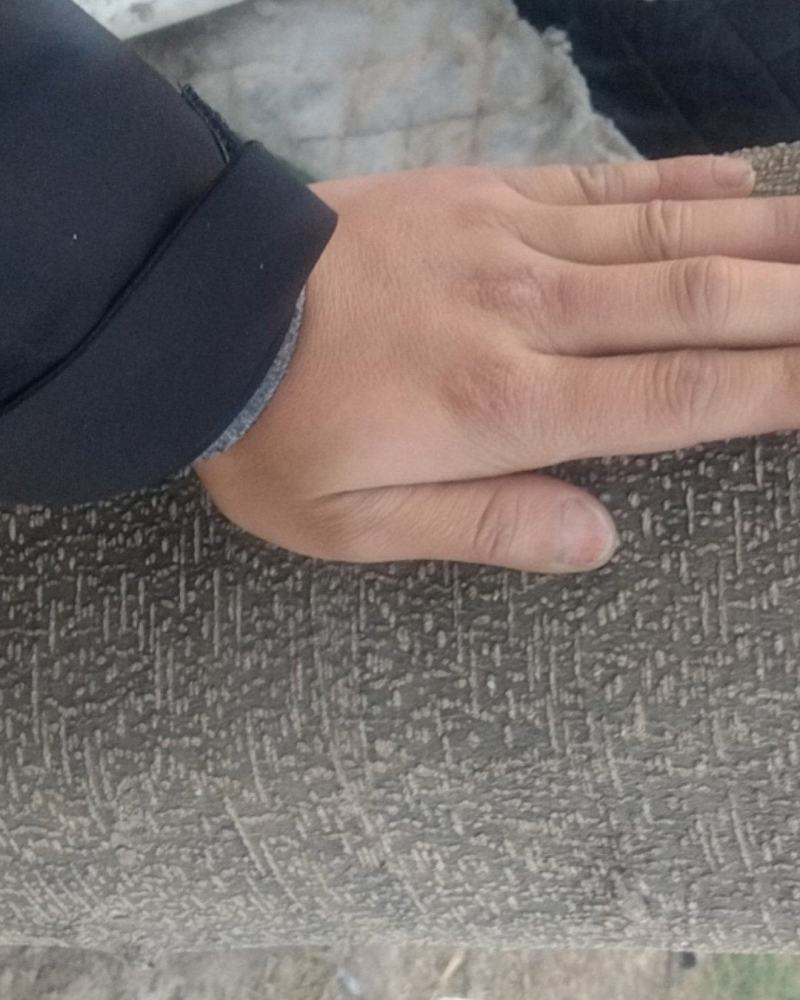 皂荚树