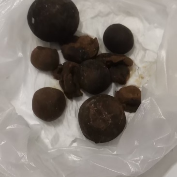 羊结石