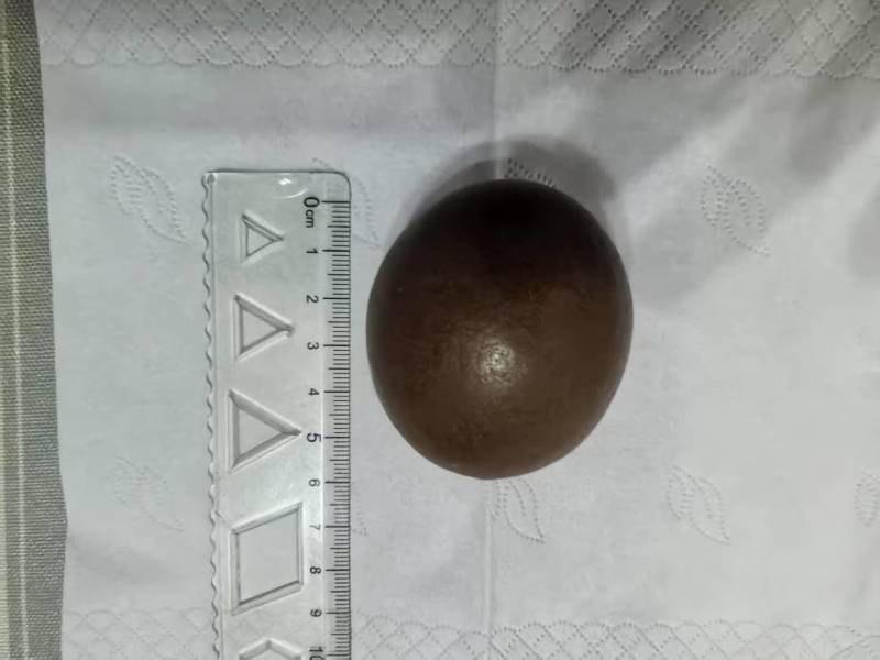 羊结石有要的私聊***********