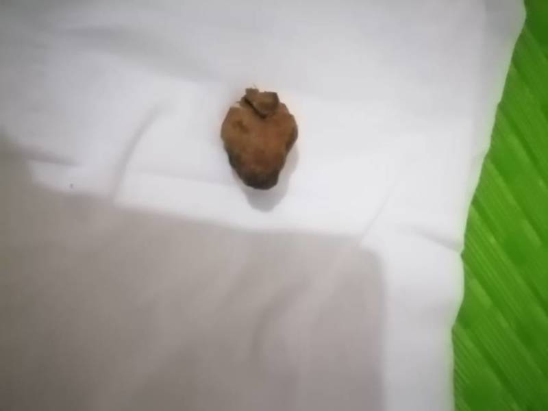 鸭宝