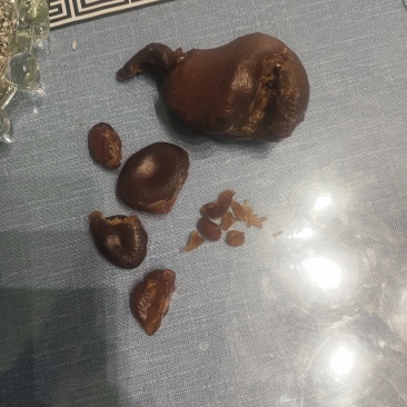 鸡宝