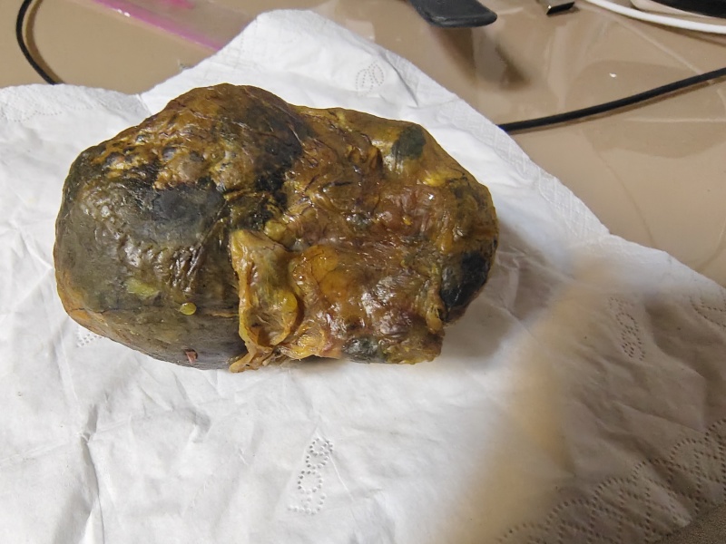 鸡宝2两重
