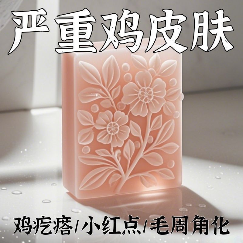 【酸鸡皮皂】鸡皮鱼鳞鸡皮疙瘩毛囊角化皮肤滋润保湿--