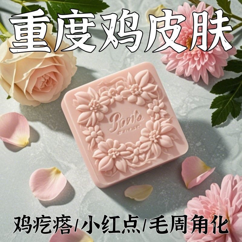 【酸鸡皮皂】鸡皮鱼鳞鸡皮疙瘩毛囊角化皮肤滋润保湿--