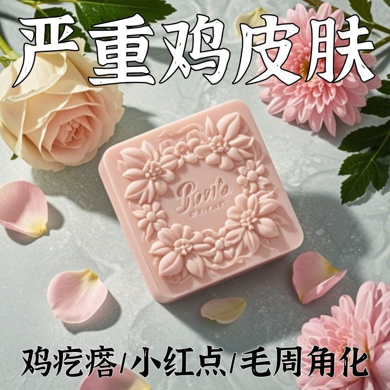 【酸鸡皮皂】鸡皮鱼鳞鸡皮疙瘩毛囊角化皮肤滋润保湿--