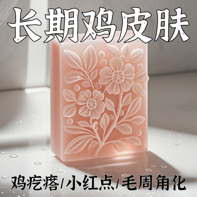 【酸鸡皮皂】鸡皮鱼鳞鸡皮疙瘩毛囊角化皮肤滋润保湿--