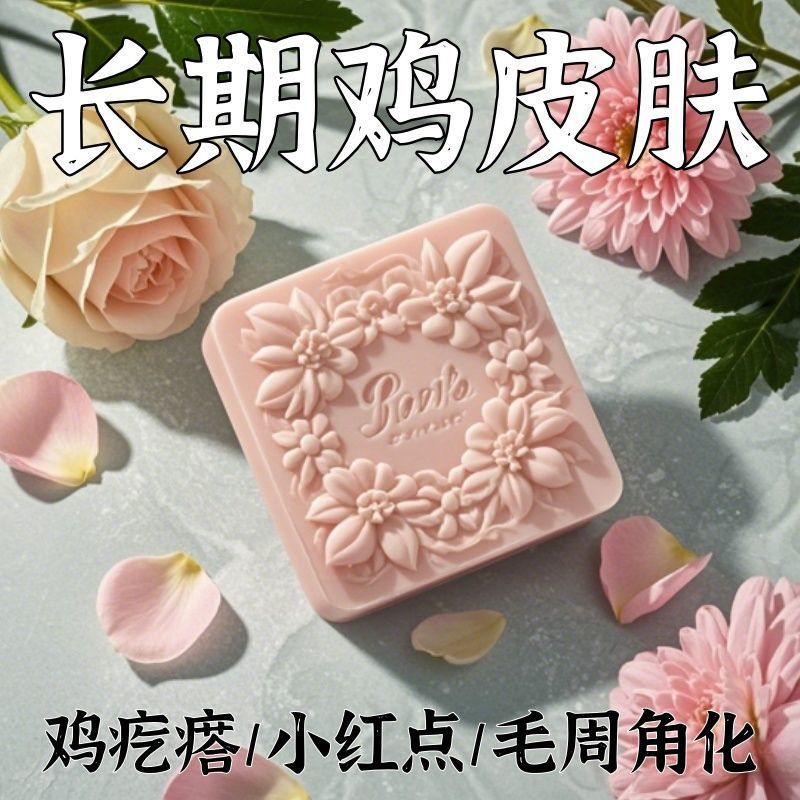 【酸鸡皮皂】鸡皮鱼鳞鸡皮疙瘩毛囊角化皮肤滋润保湿--