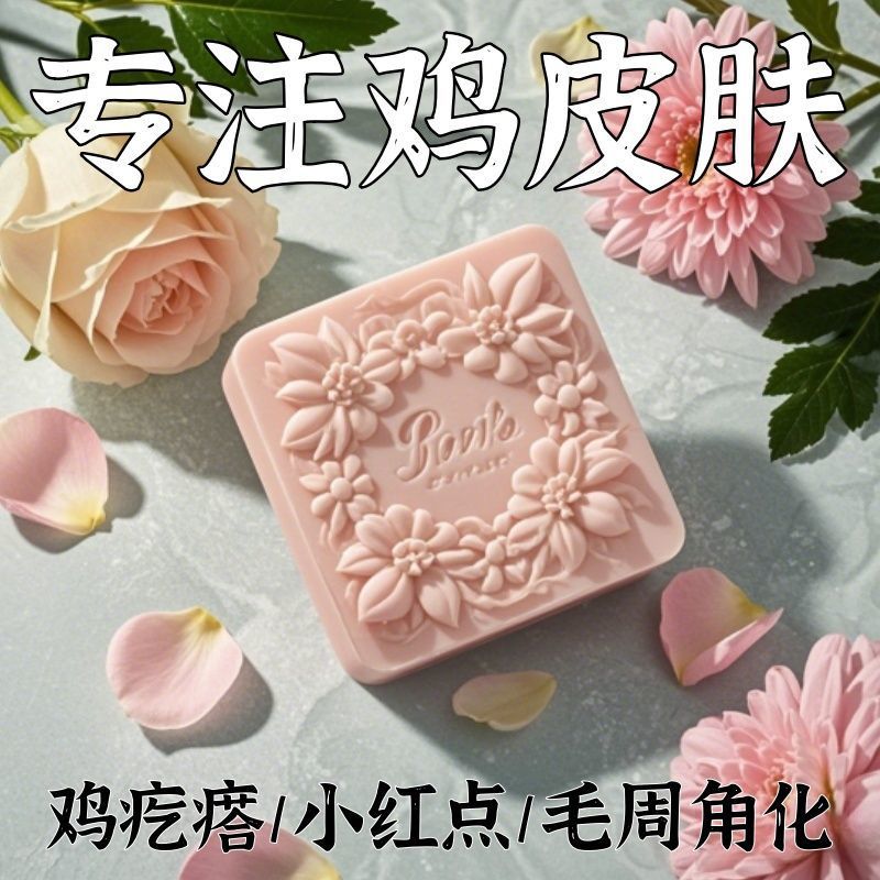 【酸鸡皮皂】鸡皮鱼鳞鸡皮疙瘩毛囊角化皮肤滋润保湿--