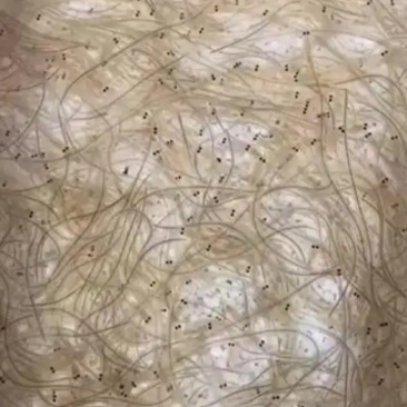 鳝鱼苗