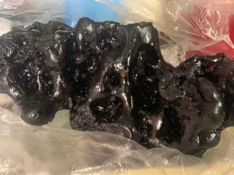 喉结