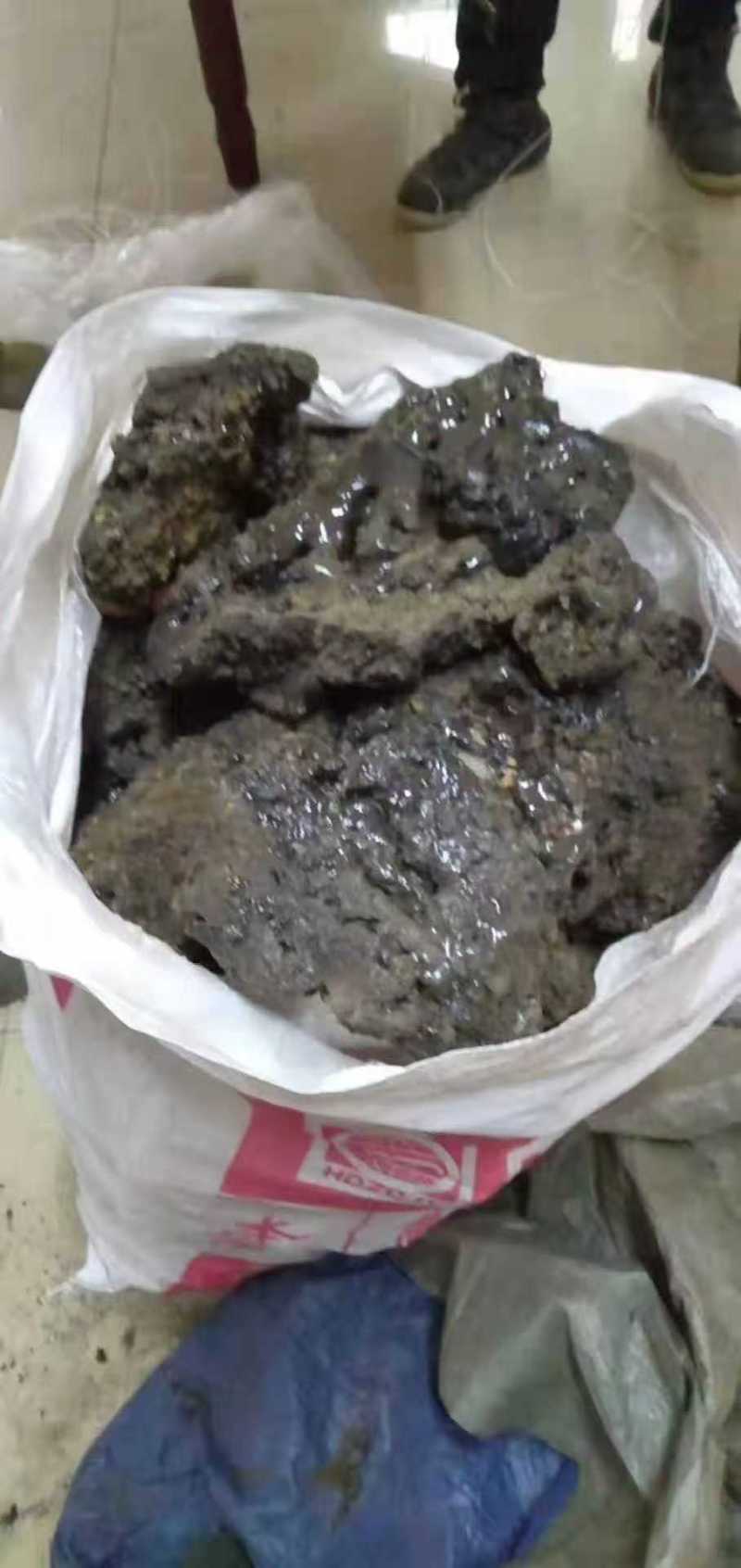 喉结