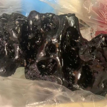 喉结