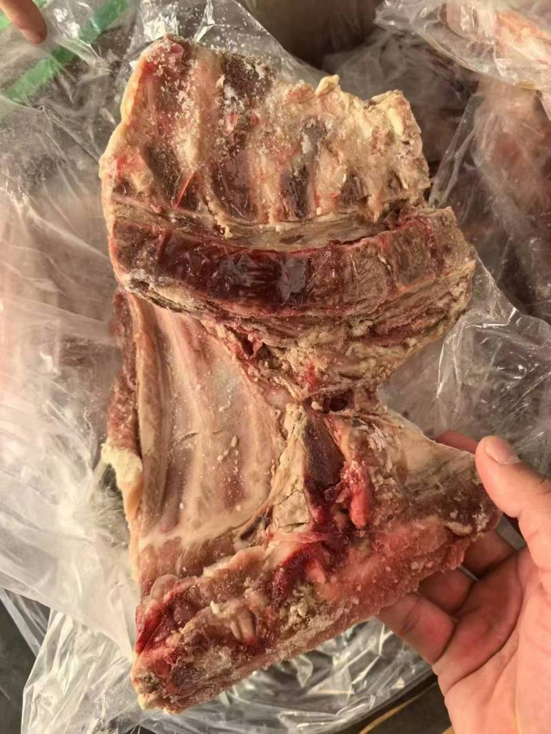 去颈前排