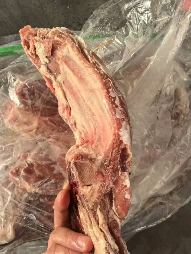 去颈前排