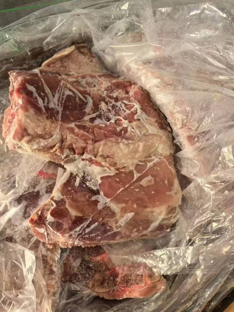 去颈前排