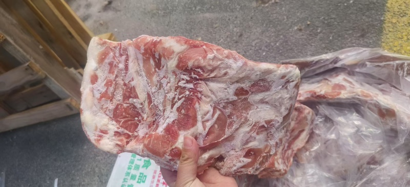去颈前排