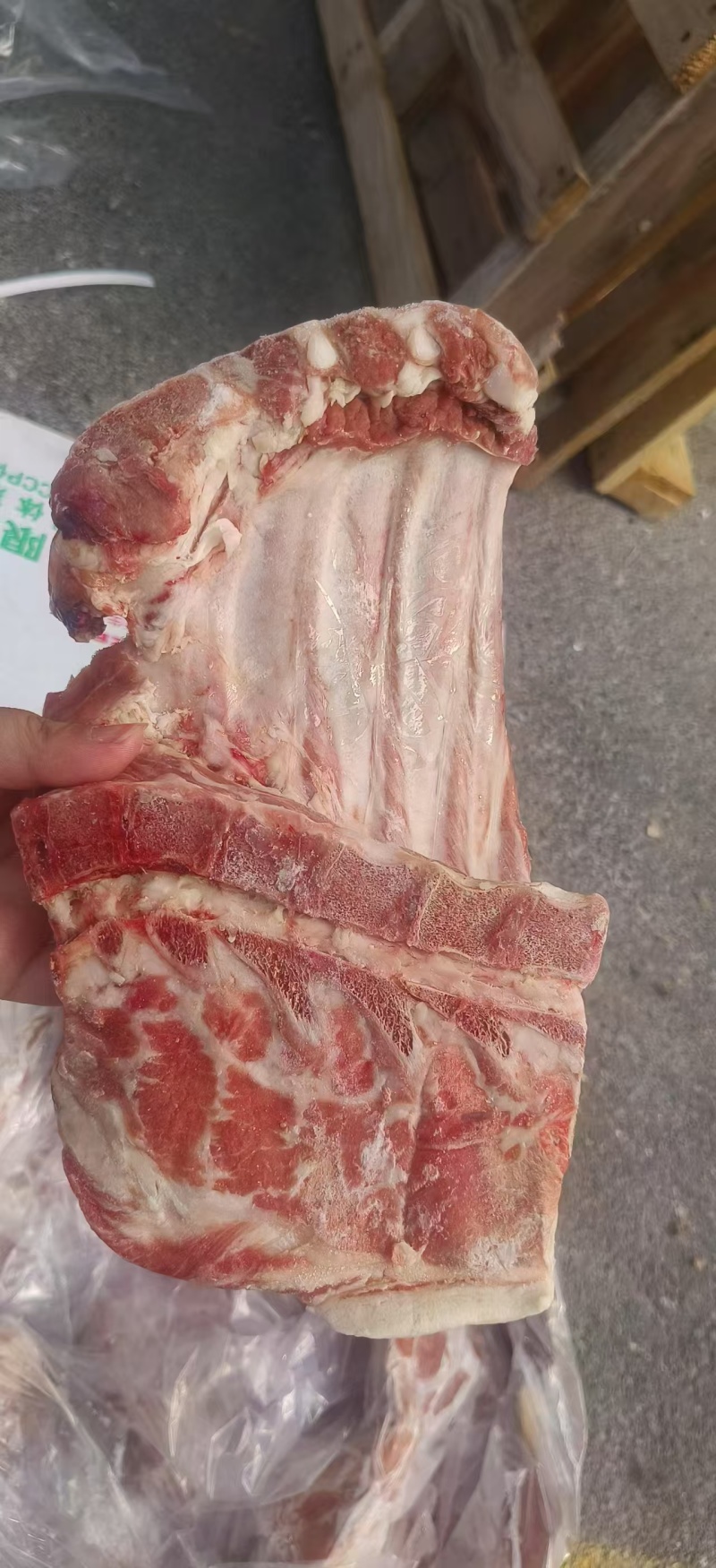 去颈前排