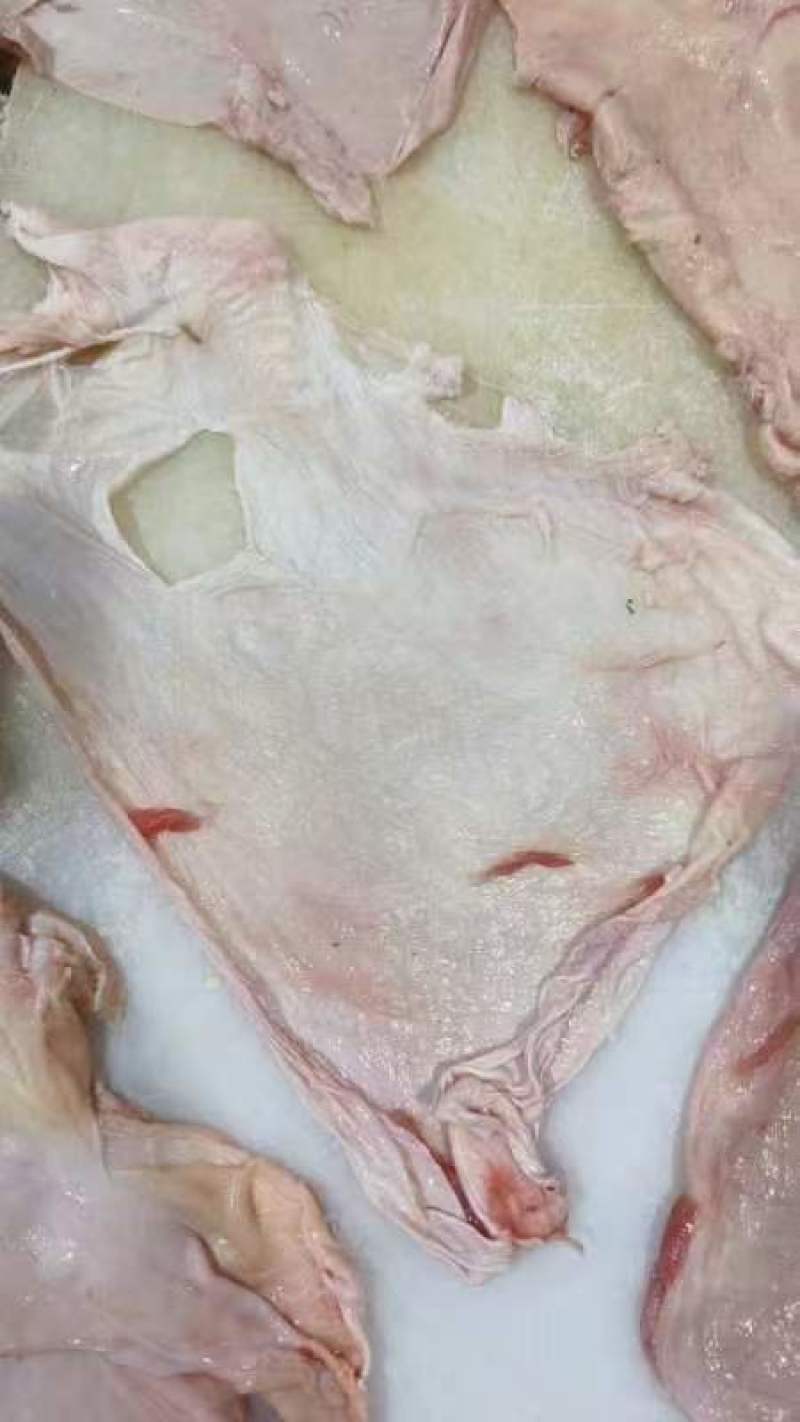 筋膜