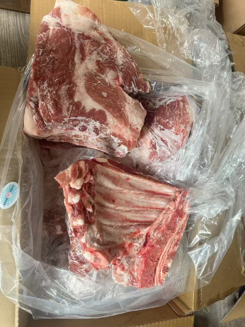 金锣去颈前排