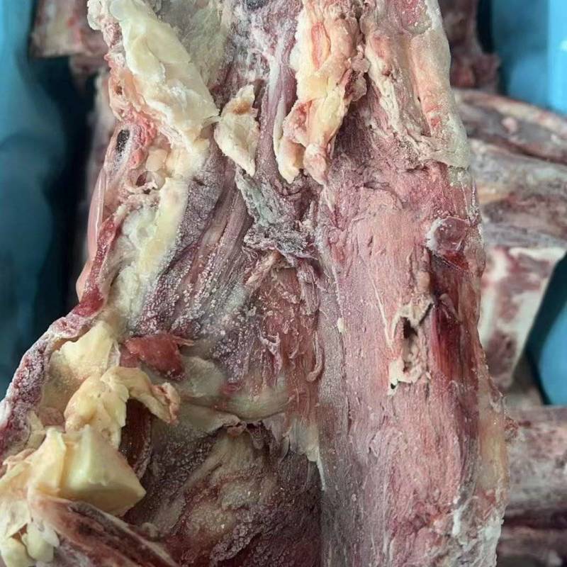 腰椎骨