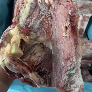 腰椎骨