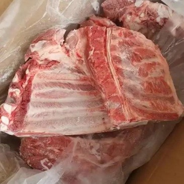 去颈前排