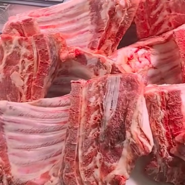 满肉无颈前排