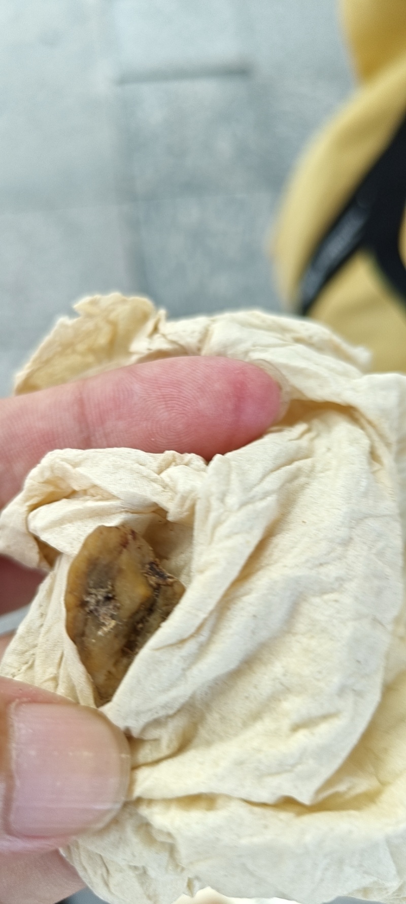 鹅宝（鹅结石）